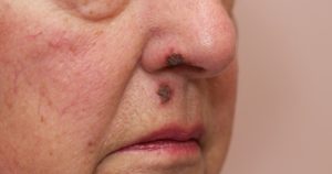 Børnesår - ikke kun for børn